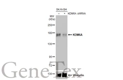 Anti-KDM6A antibody [HL2068] used in Western Blot (WB). GTX637972