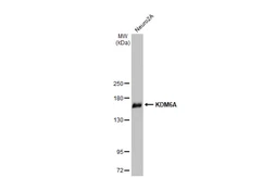 Anti-KDM6A antibody [HL2068] used in Western Blot (WB). GTX637972