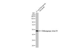 Anti-Chikungunya virus E1 antibody [HL2069] used in Western Blot (WB). GTX637973