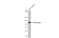 Anti-Plasminogen antibody [HL2071] used in Western Blot (WB). GTX637979