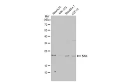 Anti-Shh antibody [HL2076] used in Western Blot (WB). GTX637984