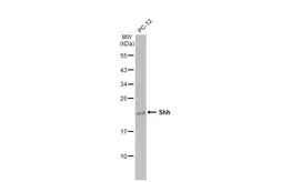 Anti-Shh antibody [HL2076] used in Western Blot (WB). GTX637984