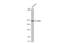 Anti-LRP4 antibody [HL2080] used in Western Blot (WB). GTX637988