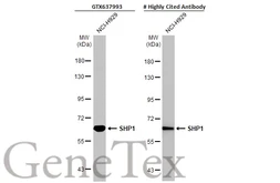 Anti-SHP1 antibody [HL20845] used in Western Blot (WB). GTX637993
