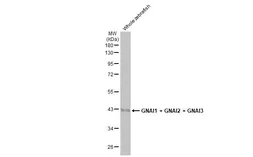 Anti-GNAI1 + GNAI2 + GNAI3 antibody [HL2093] used in Western Blot (WB). GTX638001