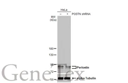 Anti-Periostin antibody [HL2112] used in Western Blot (WB). GTX638084