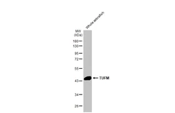 Anti-TUFM antibody [HL2117] used in Western Blot (WB). GTX638089