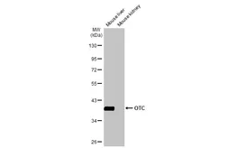 Anti-OTC antibody [HL2122] used in Western Blot (WB). GTX638094
