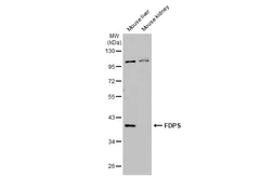 Anti-FDPS antibody [HL2123] used in Western Blot (WB). GTX638095