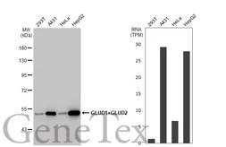 Anti-GLUD1+ GLUD2 antibody [HL2124] used in Western Blot (WB). GTX638096
