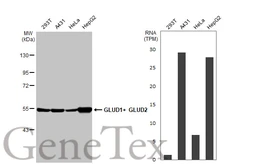 Anti-GLUD1+ GLUD2 antibody [HL2125] used in Western Blot (WB). GTX638097