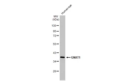 Anti-GNAT1 antibody [HL2126] used in Western Blot (WB). GTX638098