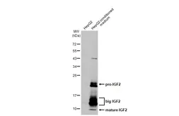 Anti-IGF2 antibody [HL2132] used in Western Blot (WB). GTX638104