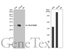Anti-HLA-DQA1 antibody [HL2139] used in Western Blot (WB). GTX638111