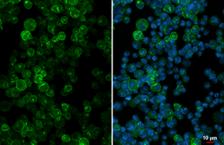 Anti-HLA-DQA1 antibody [HL2139] used in Immunocytochemistry/ Immunofluorescence (ICC/IF). GTX638111