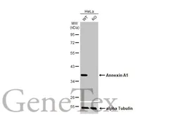 Anti-Annexin A1 antibody [HL2141] used in Western Blot (WB). GTX638119