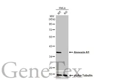 Anti-Annexin A1 antibody [HL2142] used in Western Blot (WB). GTX638120