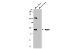 Anti-ADFP antibody [HL2145] used in Western Blot (WB). GTX638123