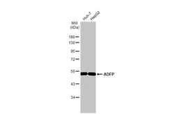 Anti-ADFP antibody [HL2147] used in Western Blot (WB). GTX638125