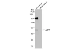 Anti-ADFP antibody [HL2147] used in Western Blot (WB). GTX638125