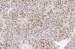 Anti-POLE antibody [HL2150] used in IHC (Paraffin sections) (IHC-P). GTX638128