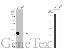 Anti-HFE antibody [HL2155] used in Western Blot (WB). GTX638133