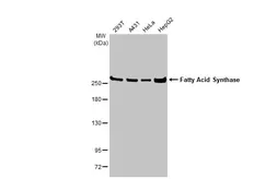 Anti-Fatty Acid Synthase antibody [HL2160] used in Western Blot (WB). GTX638138