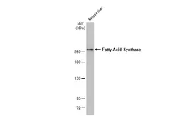 Anti-Fatty Acid Synthase antibody [HL2160] used in Western Blot (WB). GTX638138