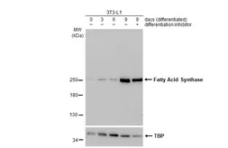Anti-Fatty Acid Synthase antibody [HL2161] used in Western Blot (WB). GTX638139