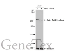 Anti-Fatty Acid Synthase antibody [HL2161] used in Western Blot (WB). GTX638139