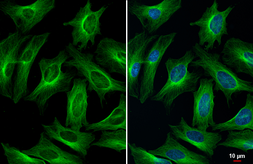Anti-alpha Tubulin antibody [HL2162] used in Immunocytochemistry/ Immunofluorescence (ICC/IF). GTX638140