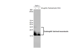 Anti-Eosinophil derived neurotoxin antibody [HL2166] used in Western Blot (WB). GTX638144