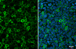 Anti-Iba1 antibody [HL1880-MS] used in Immunocytochemistry/ Immunofluorescence (ICC/IF). GTX638147