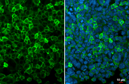 Anti-Iba1 antibody [HL1880-RT] used in Immunocytochemistry/ Immunofluorescence (ICC/IF). GTX638148