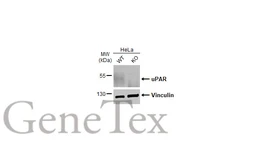 Anti-uPAR antibody [HL2169] used in Western Blot (WB). GTX638173