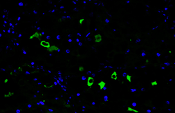 Anti-BCA1 antibody [HL2172] used in IHC (Paraffin sections) (IHC-P). GTX638176