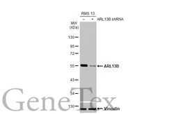 Anti-ARL13B antibody [HL2173] used in Western Blot (WB). GTX638177