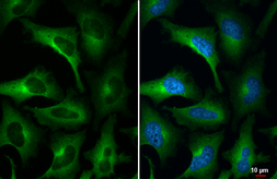 Anti-WNK1 antibody [HL2184] used in Immunocytochemistry/ Immunofluorescence (ICC/IF). GTX638188