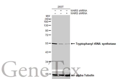 Anti-Tryptophanyl tRNA synthetase antibody [HL2186] used in Western Blot (WB). GTX638190