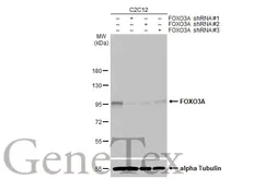 Anti-FOXO3A antibody [HL2190] used in Western Blot (WB). GTX638194