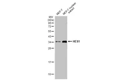Anti-HES1 antibody [HL2198] used in Western Blot (WB). GTX638202
