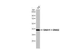 Anti-GNA11 + GNAQ antibody [HL2203] used in Western Blot (WB). GTX638207