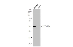 Anti-PFKFB4 antibody [HL2204] used in Western Blot (WB). GTX638208