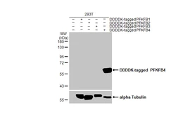 Anti-PFKFB4 antibody [HL2204] used in Western Blot (WB). GTX638208