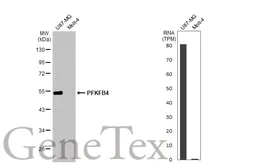 Anti-PFKFB4 antibody [HL2204] used in Western Blot (WB). GTX638208