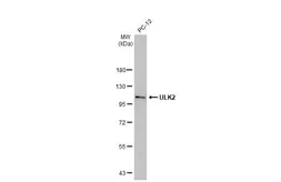 Anti-ULK2 antibody [HL2206] used in Western Blot (WB). GTX638210