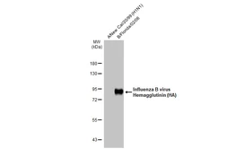 Anti-Influenza B virus Hemagglutinin (HA) antibody [HL2208] used in Western Blot (WB). GTX638212