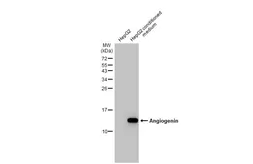 Anti-Angiogenin antibody [HL2214] used in Western Blot (WB). GTX638218