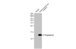 Anti-Angiogenin antibody [HL2215] used in Western Blot (WB). GTX638219