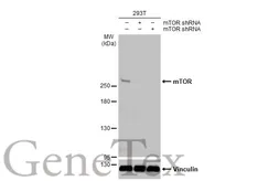 Anti-mTOR antibody [HL2216] used in Western Blot (WB). GTX638220